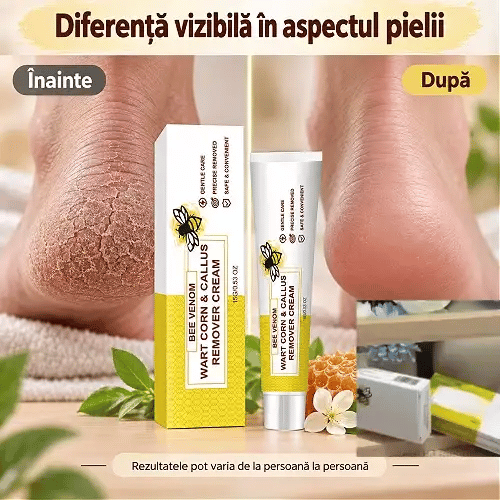 BEECREM™⭐|Cremă cu Venin de Albine pentru Bătături și Negi Plantare